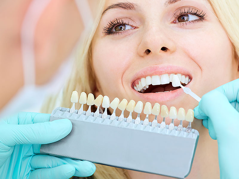 vellore woods dentistry teeth whitening