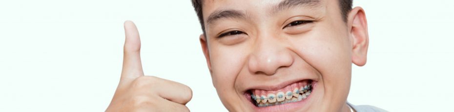guide 101 everything to consider about braces for kids
