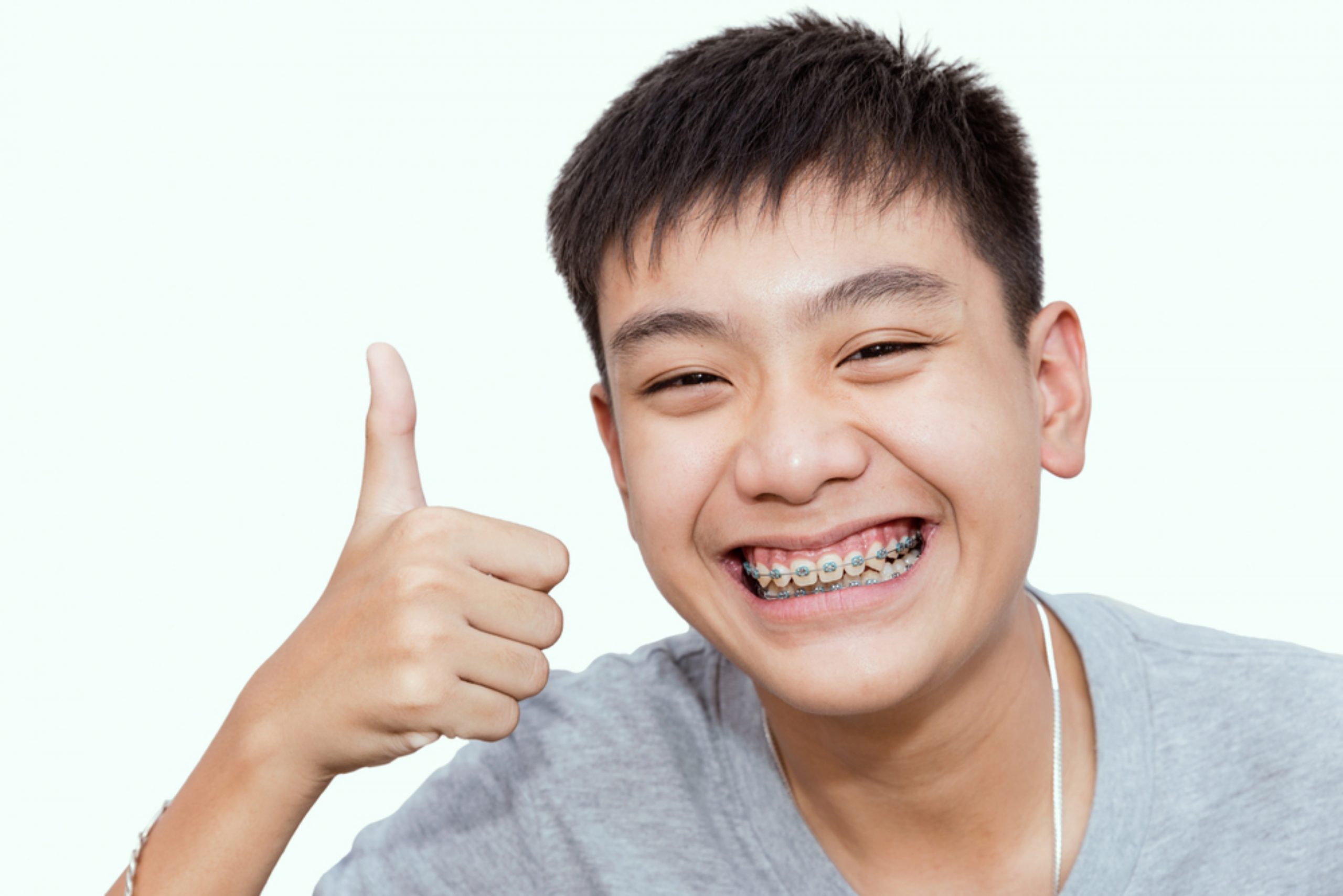 guide 101 everything to consider about braces for kids