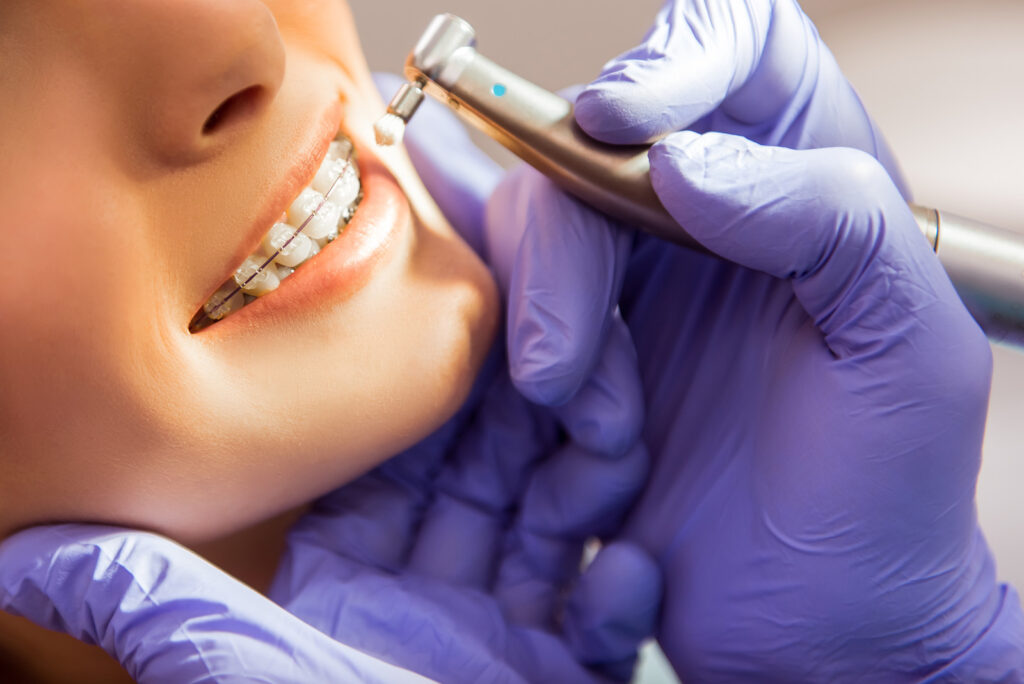 What Are The Benefits of Orthodontic Treatment?