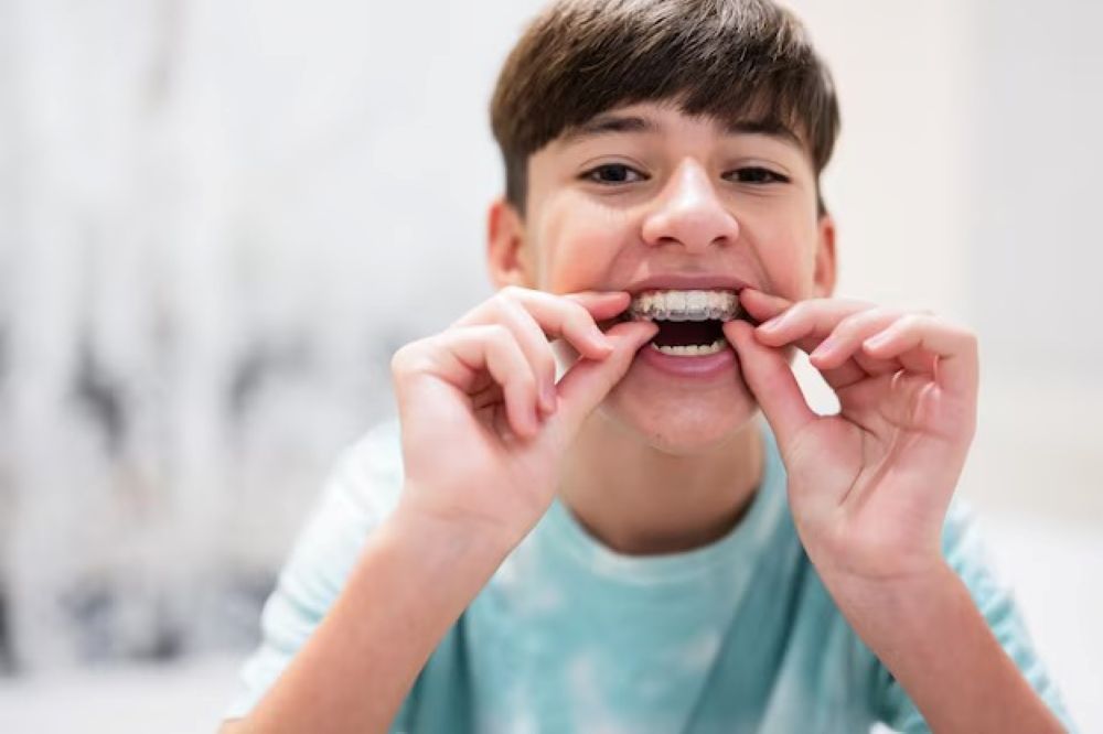 Invisalign for Teens & Kids: What Parents Should Know