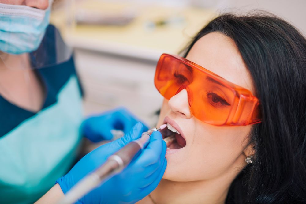 top 5 composite-filling brands recommende by dentists